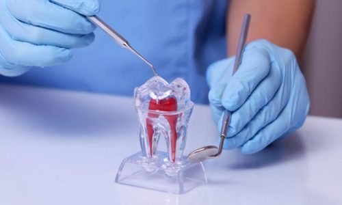 endodontia-figueiredo-filho