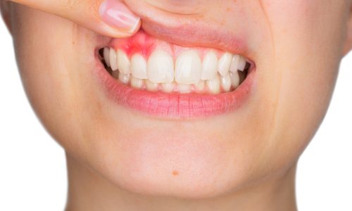 periodontia-figueiredo-filho